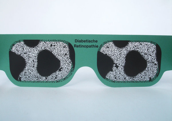 Simulationsbrille Augenkrankheiten: Diabetische Retinopathie