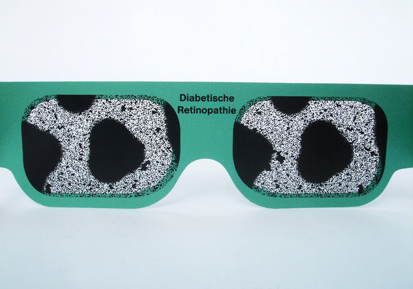 Set Simulationsbrillen Augenkrankheiten - 5 verschiedene Brillen